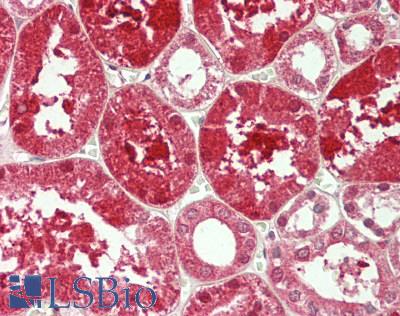 PDGF-BB Antibody - Human Kidney: Formalin-Fixed, Paraffin-Embedded (FFPE)