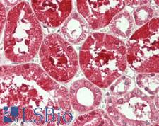 PDGF-BB Antibody - Human Kidney: Formalin-Fixed, Paraffin-Embedded (FFPE)
