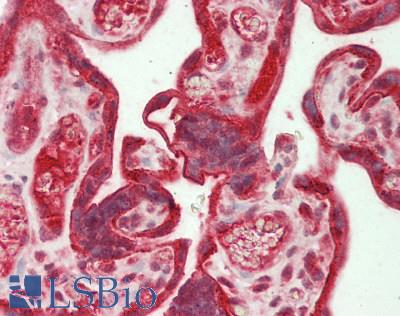 PDGF-BB Antibody - Human Placenta: Formalin-Fixed, Paraffin-Embedded (FFPE)