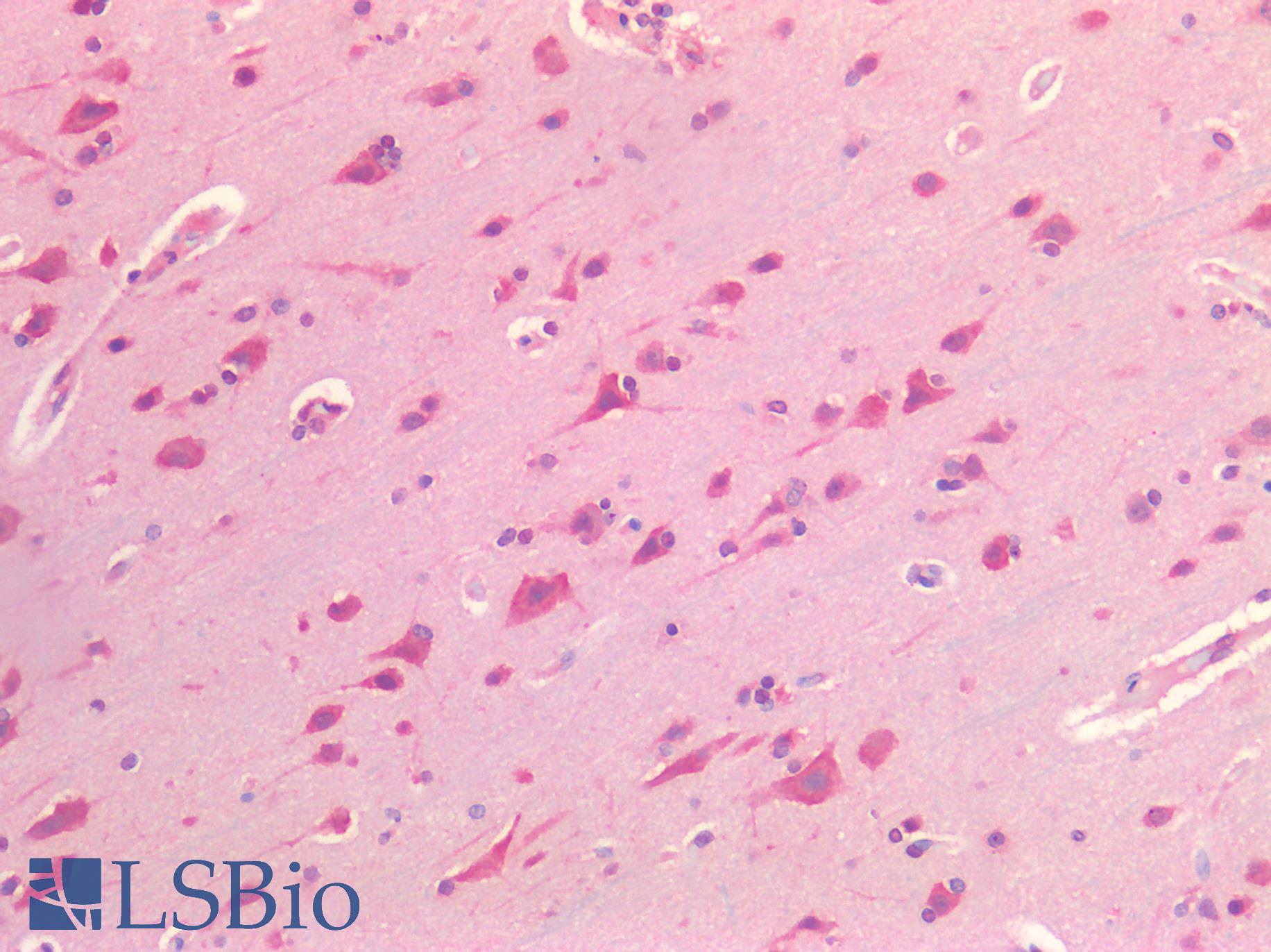 PDGFRA / PDGFR Alpha Antibody - Human Brain, Cortex: Formalin-Fixed, Paraffin-Embedded (FFPE)