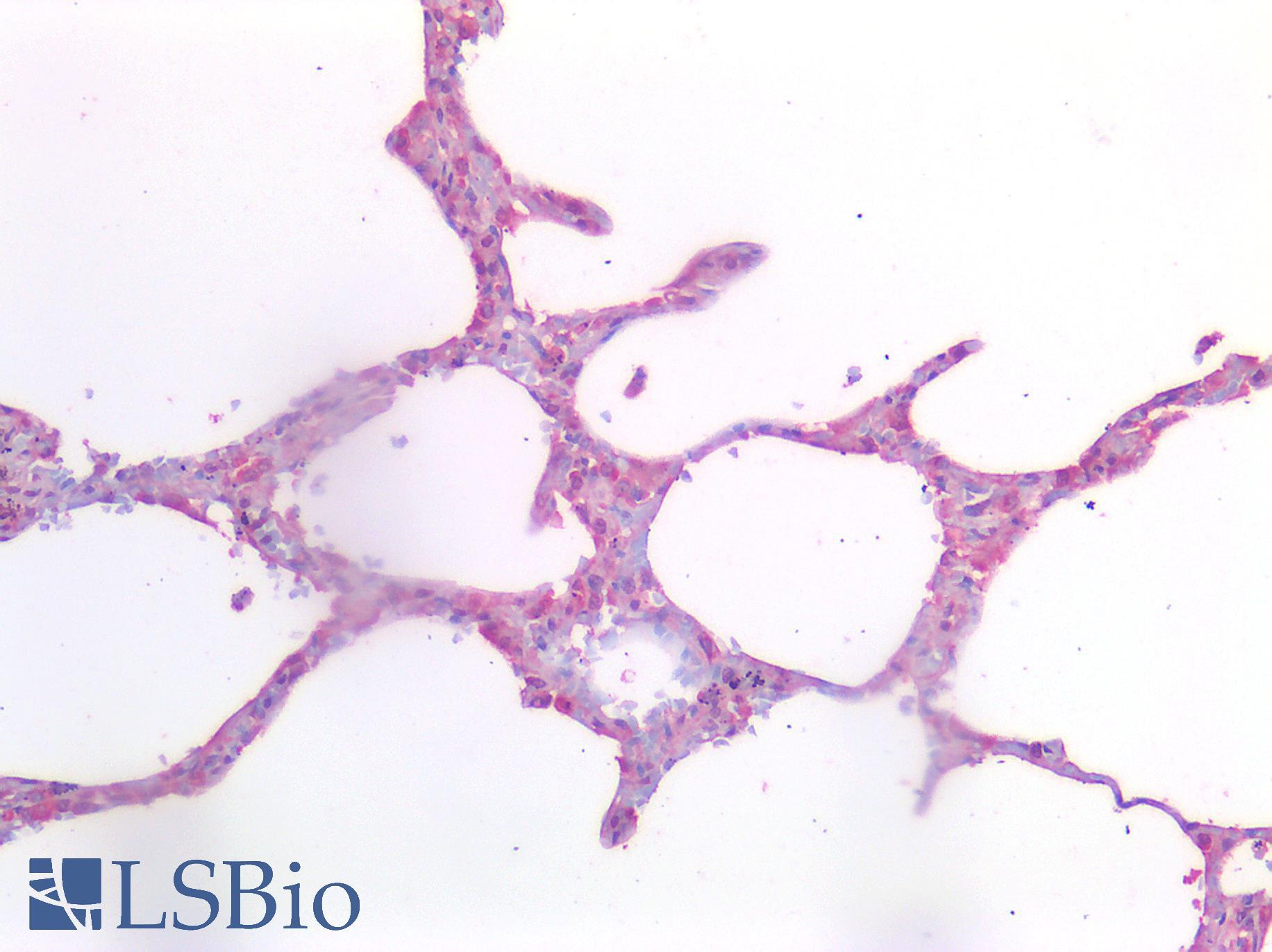 PDGFRA / PDGFR Alpha Antibody - Human Lung: Formalin-Fixed, Paraffin-Embedded (FFPE)