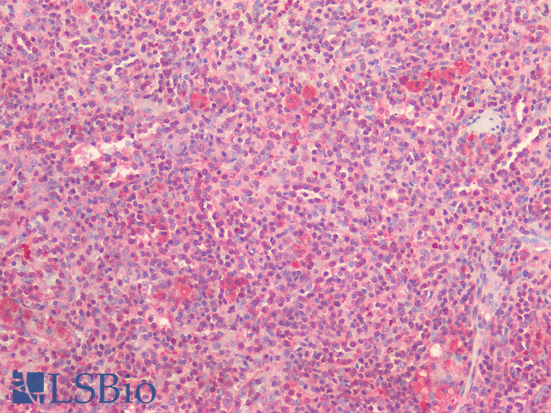 PDGFRA / PDGFR Alpha Antibody - Human Spleen: Formalin-Fixed, Paraffin-Embedded (FFPE)