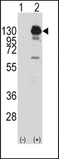 PDGFRA / PDGFR Alpha Antibody - Western blot of PDGFRA (arrow) using rabbit polyclonal PDGFRA Antibody (Y762) (RB11109). 293 cell lysates (2 ug/lane) either nontransfected (Lane 1) or transiently transfected with the PDGFRA gene (Lane 2) (Origene Technologies).