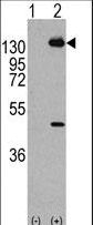 PDGFRA / PDGFR Alpha Antibody - Western blot of PDGFRA (arrow) using rabbit polyclonal PDGFRA Antibody (Y768) (RB11119). 293 cell lysates (2 ug/lane) either nontransfected (Lane 1) or transiently transfected with the PDGFRA gene (Lane 2) (Origene Technologies).