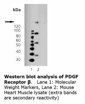 PDGFRB / PDGFR Beta Antibody