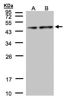 PDHA1 / PDH E1 Alpha Antibody - Sample (30 ug of whole cell lysate). A: Hep G2, B: MOLT4. 12% SDS PAGE. PDHA1 antibody diluted at 1:1000