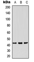 PDHA1 / PDH E1 Alpha Antibody - Western blot analysis of PDHA1 expression in HepG2 (A); HUVEC (B); HeLa (C) whole cell lysates.