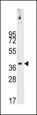 PDHX / Protein X / ProX Antibody - Western blot of anti-PDX1 Antibody (T11) in NCI-H460 cell line lysates (35 ug/lane). PDX1-T11(arrow) was detected using the purified antibody.