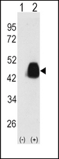 PDHX / Protein X / ProX Antibody - Western blot of PDX1 (arrow) using PDX1 Antibody (T11). 293 cell lysates (2 ug/lane) either nontransfected (Lane 1) or transiently transfected with the PDX1 gene (Lane 2) (Origene Technologies).