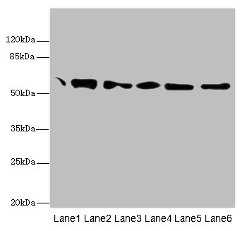 PDI / P4HB Antibody - All lanes: P4HB antibody at 1.8ug/ml Lane 1: Mouse brain tissue Lane 2: Colo320 whole cell lysate Lane 3: HepG-2 whole cell lysate Lane 4: 293T whole cell lysate Lane 5: Hela whole cell lysate Lane 6: MCF7 whole cell lysate Secondary Goat polyclonal to Rabbit IgG at 1/10000 dilution Predicted band size: 57 kDa Observed band size: 57 kDa