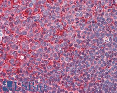 PDI / P4HB Antibody - Human Tonsil: Formalin-Fixed, Paraffin-Embedded (FFPE), at a dilution of 1:200.
