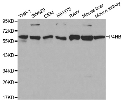 PDI / P4HB Antibody - Western blot analysis of extracts of various cell lines, using P4HB antibody at 1:1000 dilution. The secondary antibody used was an HRP Goat Anti-Rabbit IgG (H+L) at 1:10000 dilution. Lysates were loaded 25ug per lane and 3% nonfat dry milk in TBST was used for blocking.