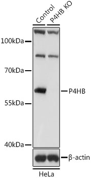 PDI / P4HB Antibody - Western blot analysis of extracts from normal (control) and P4HB knockout (KO) HeLa cells, using P4HB antibodyat 1:1000 dilution. The secondary antibody used was an HRP Goat Anti-Rabbit IgG (H+L) at 1:10000 dilution. Lysates were loaded 25ug per lane and 3% nonfat dry milk in TBST was used for blocking. An ECL Kit was used for detection and the exposure time was 1s.