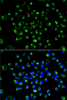 PDI / P4HB Antibody - Immunofluorescence analysis of HeLa cells using P4HB antibody. Blue: DAPI for nuclear staining.