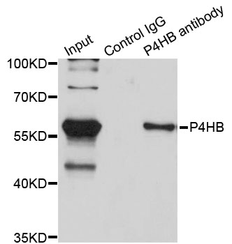 PDI / P4HB Antibody - Immunoprecipitation analysis of 200ug extracts of SW620 cells using 3ug P4HB antibody. Western blot was performed from the immunoprecipitate using P4HB antibodyat a dilition of 1:500.