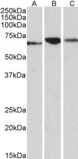 PDIA2 Antibody - Goat Anti-PDIA2 (aa477-481) Antibody (0.1µg/ml) staining of Human (A), Mouse (B) and Rat (C) Pancreas lysates (35µg protein in RIPA buffer). Primary incubation was 1 hour. Detected by chemiluminescencence.
