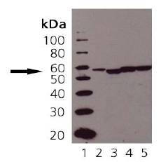 PDIA3 / ERp57 Antibody - Western blot of ERp57 (Grp58): Lane 1: MWM, Lane 2: CHO-K1 lysate, Lane 3: Human Liver Microsomes, Lane 4: Rat Liver Microsomes, Lane 5: Mouse Liver Microsomes