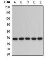PDIA6 / ERP5 Antibody - Western blot analysis of ERp5 expression in SW480 (A); HepG2 (B); mouse lung (C); mouse testis (D); rat liver (E) whole cell lysates.
