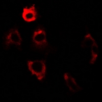 PDIA6 / ERP5 Antibody - Immunofluorescent analysis of ERp5 staining in U2OS cells. Formalin-fixed cells were permeabilized with 0.1% Triton X-100 in TBS for 5-10 minutes and blocked with 3% BSA-PBS for 30 minutes at room temperature. Cells were probed with the primary antibody in 3% BSA-PBS and incubated overnight at 4 deg C in a humidified chamber. Cells were washed with PBST and incubated with a DyLight 594-conjugated secondary antibody (red) in PBS at room temperature in the dark.