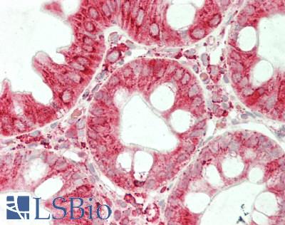 PDIA6 / ERP5 Antibody - Human Colon: Formalin-Fixed, Paraffin-Embedded (FFPE)