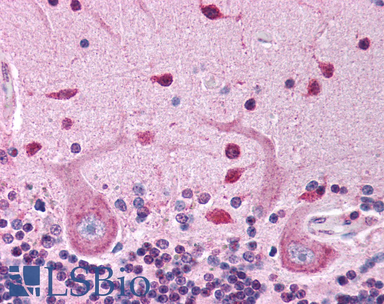 PDK1 Antibody - Anti-PDK1 antibody IHC of human brain, cerebellum. Immunohistochemistry of formalin-fixed, paraffin-embedded tissue after heat-induced antigen retrieval. Antibody concentration 5 ug/ml.  This image was taken for the unconjugated form of this product. Other forms have not been tested.