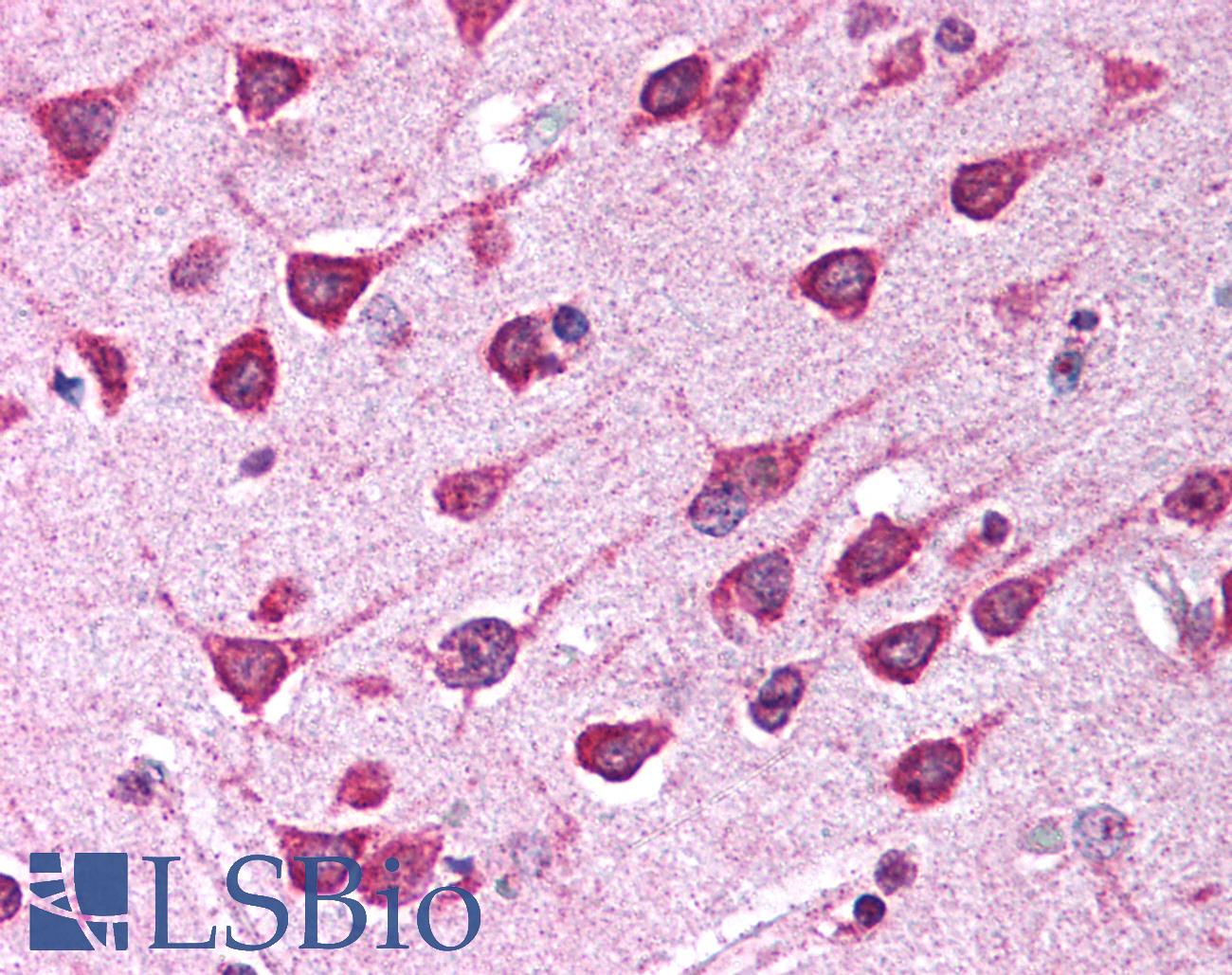 PDK1 Antibody - Anti-PDK1 antibody IHC of human brain, cortex. Immunohistochemistry of formalin-fixed, paraffin-embedded tissue after heat-induced antigen retrieval. Antibody concentration 5 ug/ml.  This image was taken for the unconjugated form of this product. Other forms have not been tested.