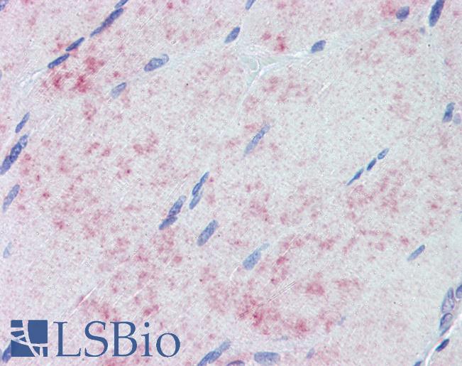 PDK1 Antibody - Anti-PDK1 antibody IHC of human skeletal muscle. human. Immunohistochemistry of formalin-fixed, paraffin-embedded tissue after heat-induced antigen retrieval. Antibody concentration 10 ug/ml.