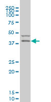 PDK2 Antibody - PDK2 monoclonal antibody clone 2G1 Western blot of PDK2 expression in U-2 OS.