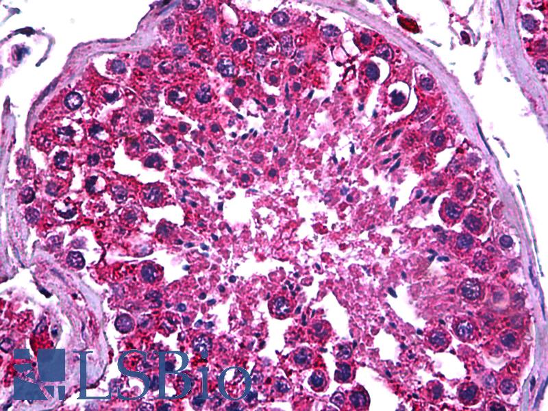 PDK2 Antibody - Anti-PDK2 antibody IHC of human testis. Immunohistochemistry of formalin-fixed, paraffin-embedded tissue after heat-induced antigen retrieval. Antibody concentration 5 ug/ml.