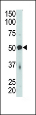 PDK4 Antibody - The PDK4 Antibody is used in Western blot to detect PDK4 in mouse skeletal muscle tissue lysate.
