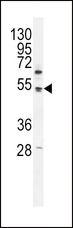 PDK4 Antibody - PDK4 Antibody (C396) western blot of K562 cell line lysates (35 ug/lane). The PDK4 antibody detected the PDK4 protein (arrow).