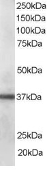 PDLIM1 Antibody - Antibody staining (0.1 ug/ml) of human lung lysate (RIPA buffer, 35 ug total protein per lane). Primary incubated for 1 hour. Detected by Western blot of chemiluminescence.