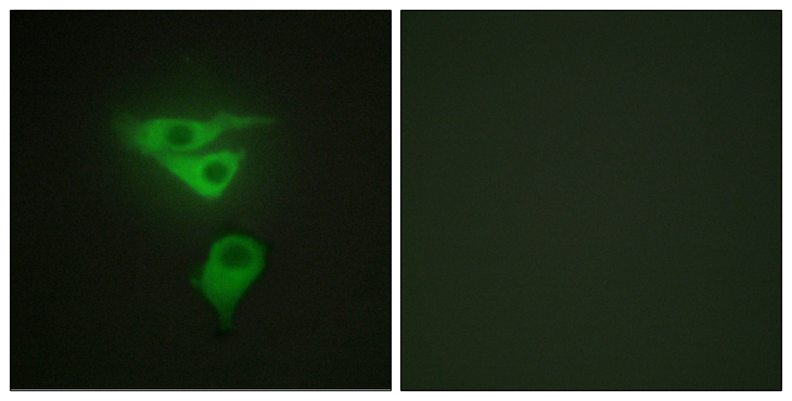 PDLIM1 Antibody - Immunofluorescence analysis of HepG2 cells, using PDLIM1 Antibody. The picture on the right is blocked with the synthesized peptide.