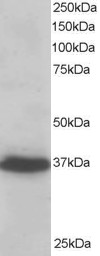PDLIM4 / RIL Antibody - Antibody staining (0.2 ug/ml) of A431 lysate (RIPA buffer, 35 ug total protein per lane). Primary incubated for 1 hour. Detected by western blot using chemiluminescence.
