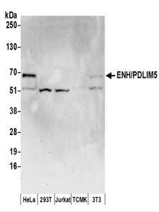 PDLIM5 / LIM Antibody - Detection of Human and Mouse ENH/PDLIM5 by Western Blot. Samples: Whole cell lysate (50 ug) prepared using NETN buffer from HeLa, 293T, Jurkat, mouse TCMK-1, and mouse NIH3T3 cells. Antibodies: Affinity purified rabbit anti-ENH/PDLIM5 antibody used for WB at 0.1 ug/ml. Detection: Chemiluminescence with an exposure time of 75 seconds.