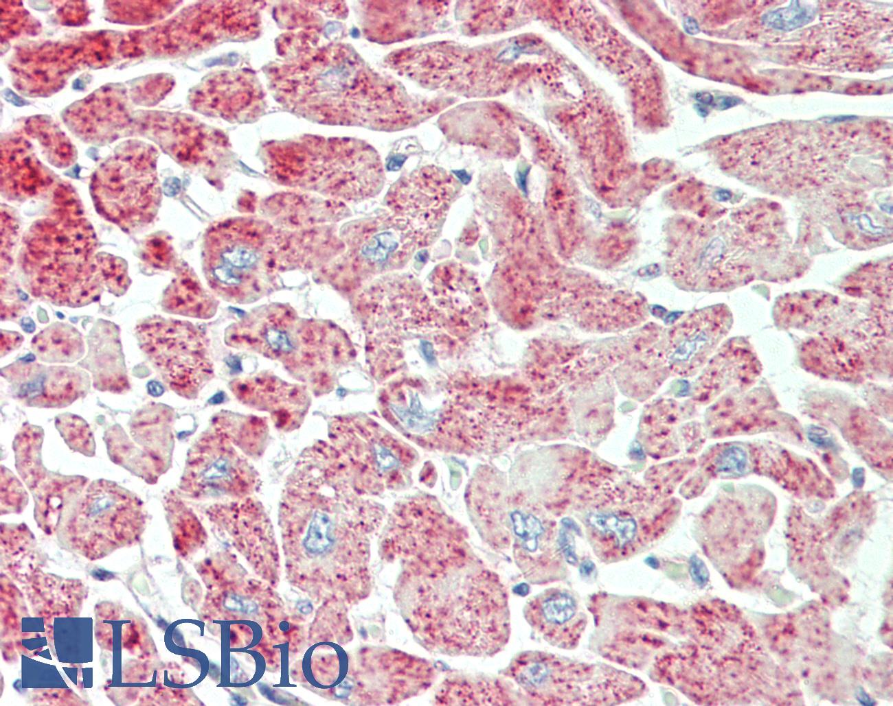 PDLIM5 / LIM Antibody - Anti-PDLIM5 / LIM antibody IHC staining of human heart. Immunohistochemistry of formalin-fixed, paraffin-embedded tissue after heat-induced antigen retrieval. Antibody dilution 1:100.