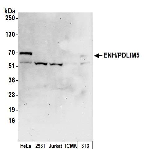 PDLIM5 / LIM Antibody - Detection of human and mouse ENH/PDLIM5 by western blot. Samples: Whole cell lysate (50 µg) prepared using NETN buffer from HeLa, HEK293T, Jurkat, mouse TCMK-1, and mouse NIH 3T3 cells. Antibodies: Affinity purified rabbit anti-ENH/PDLIM5 antibody used for WB at 0.1 µg/ml. Detection: Chemiluminescence with an exposure time of 75 seconds.