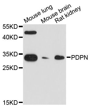 PDPN / Podoplanin Antibody - Western blot analysis of extracts of various cell lines, using PDPN antibody at 1:1000 dilution. The secondary antibody used was an HRP Goat Anti-Rabbit IgG (H+L) at 1:10000 dilution. Lysates were loaded 25ug per lane and 3% nonfat dry milk in TBST was used for blocking. An ECL Kit was used for detection and the exposure time was 90s.