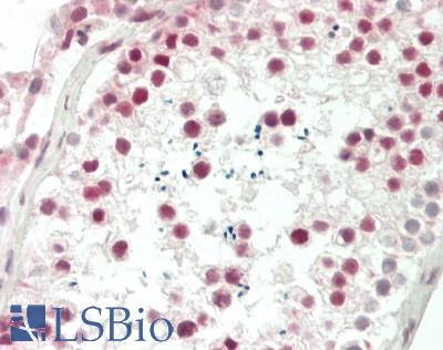PDS5A Antibody - Human Testis: Formalin-Fixed, Paraffin-Embedded (FFPE)