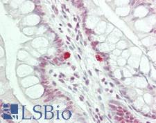 PDS5B / AS3 Antibody - Human Small Intestine: Formalin-Fixed, Paraffin-Embedded (FFPE)