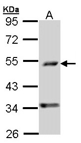 PDSS2 / DLP1 Antibody - Sample (30 ug of whole cell lysate). A: A431 . 10% SDS PAGE. PDSS2 / DLP1 antibody diluted at 1:1000.