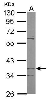 PDSS2 / DLP1 Antibody - Sample (50 ug of whole cell lysate). A: Mouse brain. 10% SDS PAGE. PDSS2 / DLP1 antibody diluted at 1:1000.