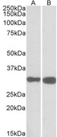 PDXP / Pyridoxal Phosphatase Antibody - Goat Anti-PDXP Antibody (0.1µg/ml) staining of Mouse (A) and Rat (B) Brain lysates (35µg protein in RIPA buffer). Detected by chemiluminescencence.