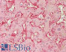 PDZK1 Antibody - Human Liver: Formalin-Fixed, Paraffin-Embedded (FFPE)