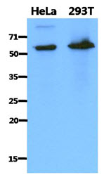 PDZK1 Antibody - Western Blot: The cell lysates of HeLa (40 ug) and 293T (40 ug) were resolved by SDS-PAGE, transferred to PVDF membrane and probed with anti-human PDZK1 antibody (1:1000). Proteins were visualized using a goat anti-mouse secondary antibody conjugated to HRP and an ECL detection system.