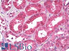 PEA15 / PEA-15 Antibody - Anti-PEA15 antibody IHC of human kidney, tubules. Immunohistochemistry of formalin-fixed, paraffin-embedded tissue after heat-induced antigen retrieval. Antibody dilution 1:100.