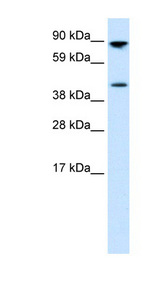 PEA3 / ETV4 Antibody - ETV4 / PEA3 antibody Western blot of Fetal small intestine lysate. This image was taken for the unconjugated form of this product. Other forms have not been tested.