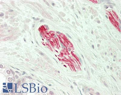 PEAK1 / SGK269 Antibody - Human Prostate, Nerve: Formalin-Fixed, Paraffin-Embedded (FFPE)