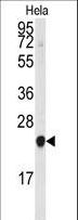 PEBP1 / RKIP Antibody - The anti-PBP antibody is used in Western blot to detect PBP in HeLa cell lysate.
