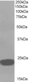 PEBP1 / RKIP Antibody - PEBP1 / RKIP antibody (1µg/ml) staining of A549 lysate (35µg protein in RIPA buffer). Detected by chemiluminescence.